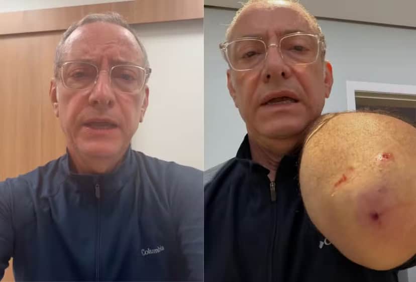 O jornalista José Roberto Burnier, da Globo, sofreu um ataque de pitbull (Foto: Reprodução/Instagram) O jornalista José Roberto Burnier, da Globo, sofreu um ataque de pitbull (Foto: Reprodução/Instagram)