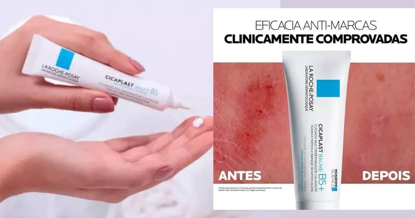 La Roche-Posay Cicaplast Baume B5 (Foto Reprodução/Montagem/Lennita/TV Foco/Canva/Google Shopping)