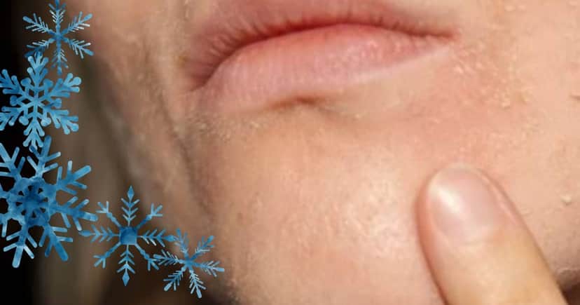Como evitar o ressecamento da pele no inverno com os produtos certos (Foto Reprodução/Montagem/TV Foco/Canva/Paola) Como evitar o ressecamento da pele no inverno com os produtos certos (Foto Reprodução/Montagem/TV Foco/Canva/Paola)