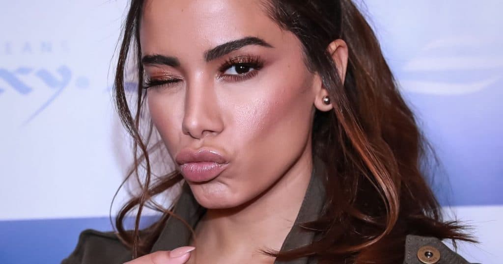 Anitta surge irreconhecível em foto sem maquiagem