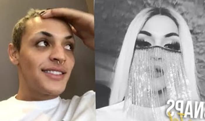 Pabllo Vittar passa por um processo cirúrgico no joelho, mas garante estar bem