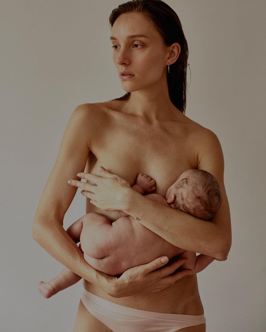 Isabel Hickman com seu filho Francisco, que nasceu com lábio leporino. Isabel Hickman com seu filho Francisco, que nasceu com lábio leporino.