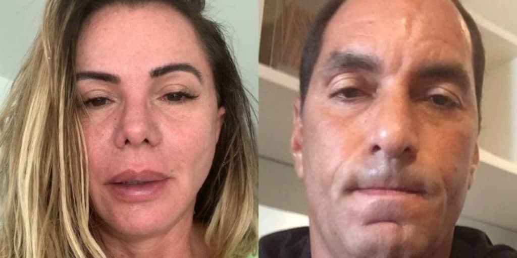 Ex de Edmundo vai ao fundo poço, suplica por ajuda e expõe doença preocupante: "Sem forças"
