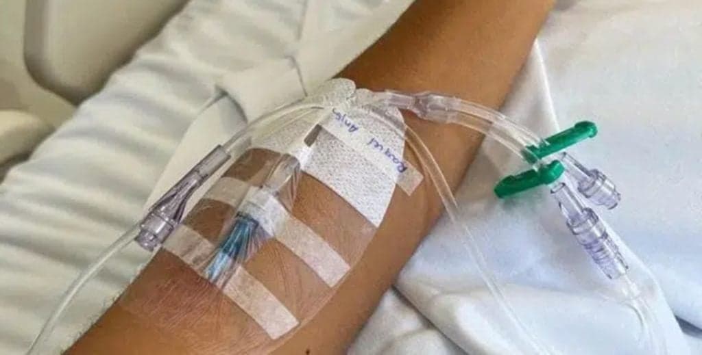 Ex-peoa de "A Fazenda", da Record TV, passa por nova cirurgia para tentar salvar nariz: "Buraco torto"
