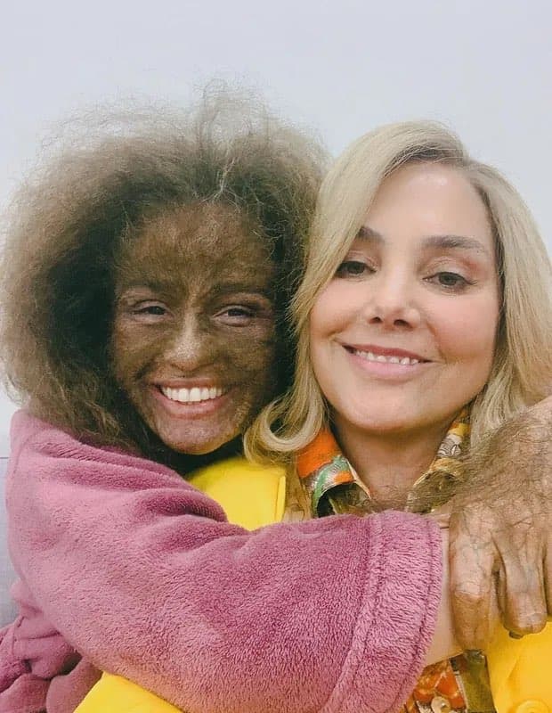 Nanda Costa surge em foto completamente peluda e choca a todos Nanda Costa surge em foto completamente peluda e choca a todos