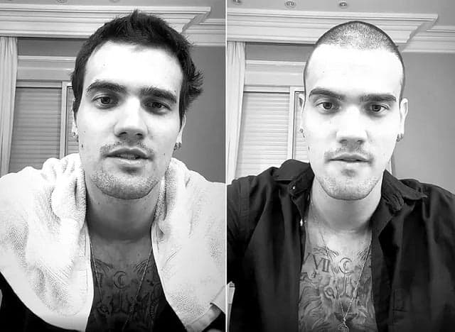 Breno antes e depois de raspar a cabeça - Foto: Reprodução/Instagram Breno antes e depois de raspar a cabeça - Foto: Reprodução/Instagram