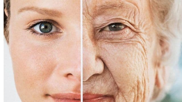 Algumas dicas para fugir das rugas e do botox (Foto: Reprodução/ Internet) Algumas dicas para fugir das rugas e do botox (Foto: Reprodução/ Internet)