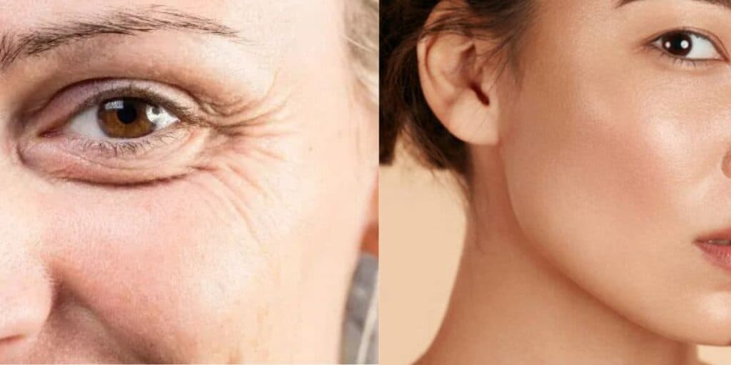 Fim IMEDIATO das rugas: Receitinha milagrosa com mel e +2 ingredientes caseiros rejuvenesce senhoras de 60+