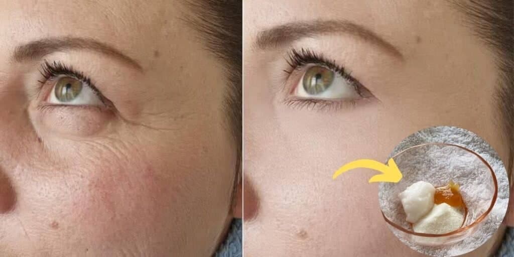 Fim das rugas em 20 minutos: Receita caseira só com 4 ingredientes é melhor que qualquer botox