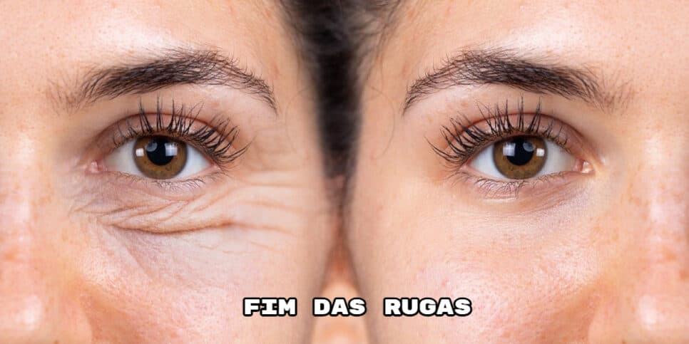 Melhor colágeno do mundo: Receitinha caseira com 3 ingredientes suga todas as rugas e traz pele radiante