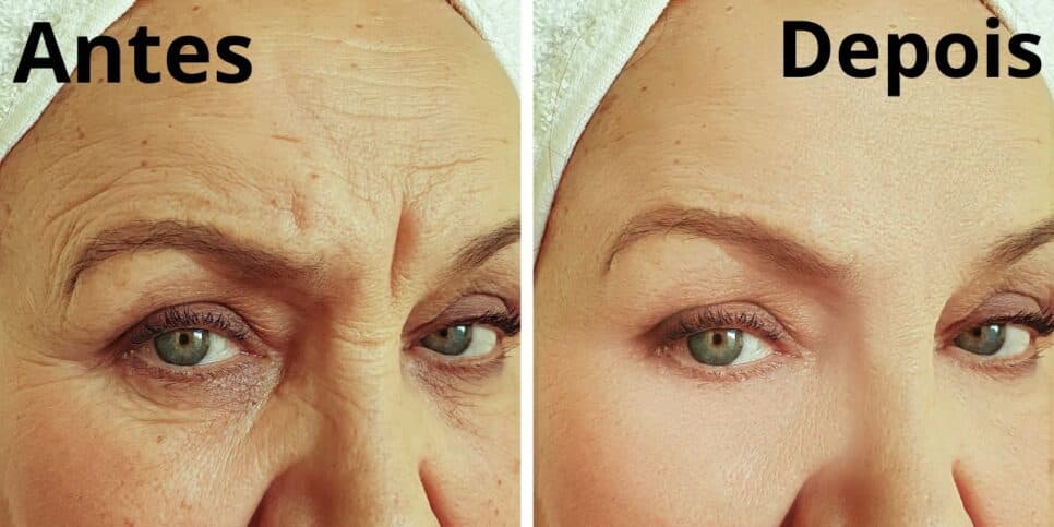 FIM das rugas e rostinho de porcelana: 5 receitas caseiras que rejuvenesce 20 anos e traz pele de bebê