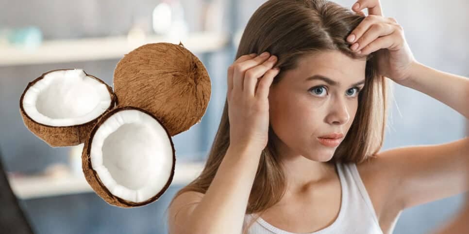 Fim do ressecamento: 2 misturas naturais com coco trazem pele de porcelana e cabelo impecável no frio