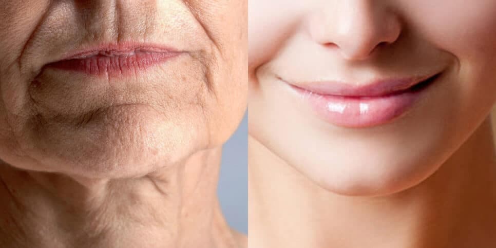 2 truques infalíveis acabam com o bigode chinês das idosas 60+