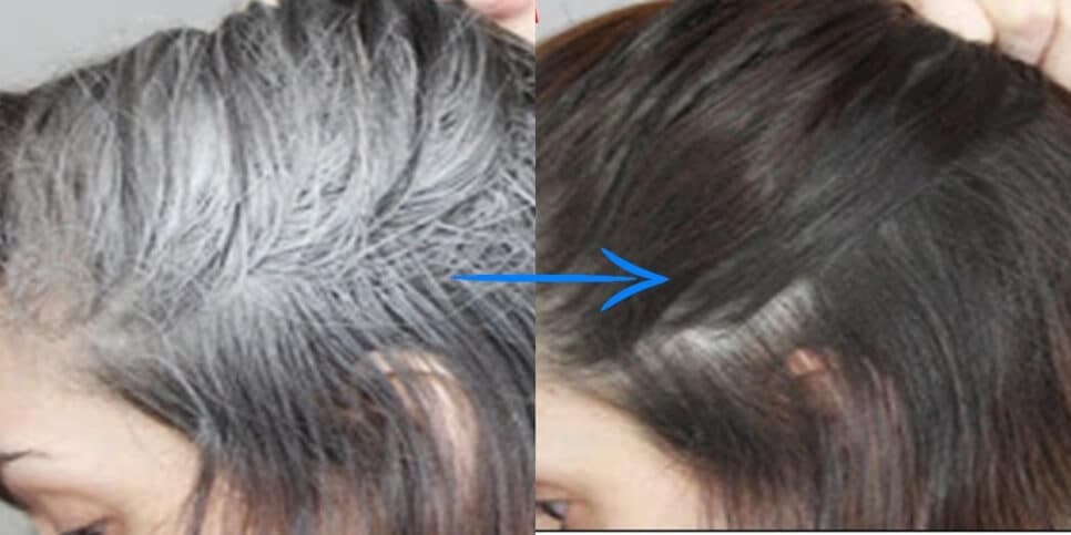 Receita com 4 ingredientes promete acabar com o cabelo grisalho sem tinta