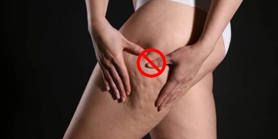 Tchau, celulites: Único ingrediente caseiro permite eliminar pesadelo da sua perna