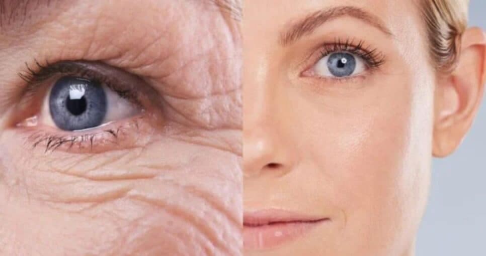Adeus rugas e sinais da idade: Hidratante caseiro com 3 ingredientes deixa a pele lisinha em 20 minutos