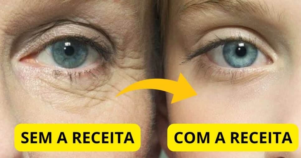 Pele firme e lisinha: Mistura caseira com 2 ingredientes remove rugas profundas em 20 minutos