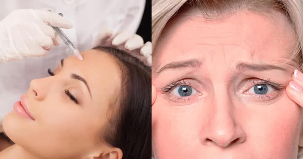 Adeus ao Botox: Receita com mel e +3 ingredientes caseiros dá fim às rugas e rejuvenesce às 50+ em 20 anos