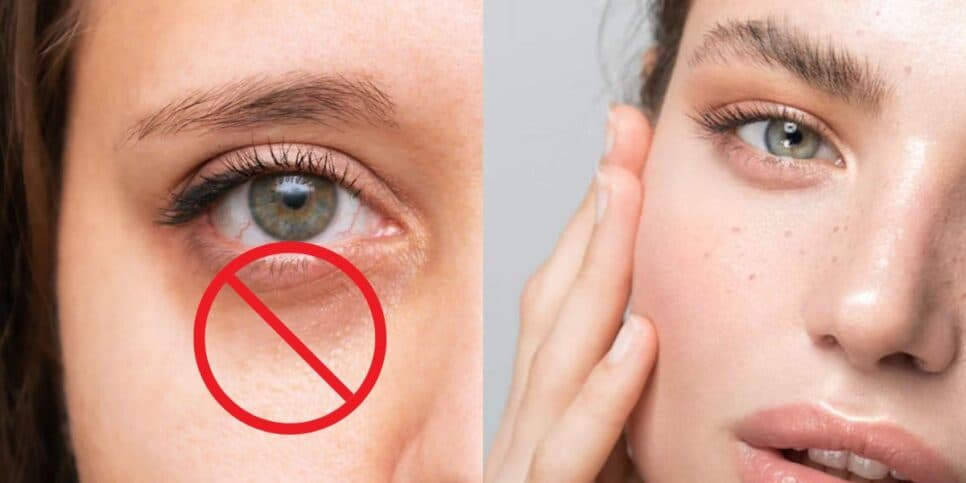 Fim das olheiras e flacidez: Misturinha caseira com 3 ingredientes traz pele de porcelana às mulheres 40+