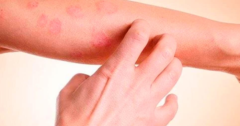 Cuidado: 5 sintomas silenciosos que indicam câncer de pele e você deve ir ao médico às pressas