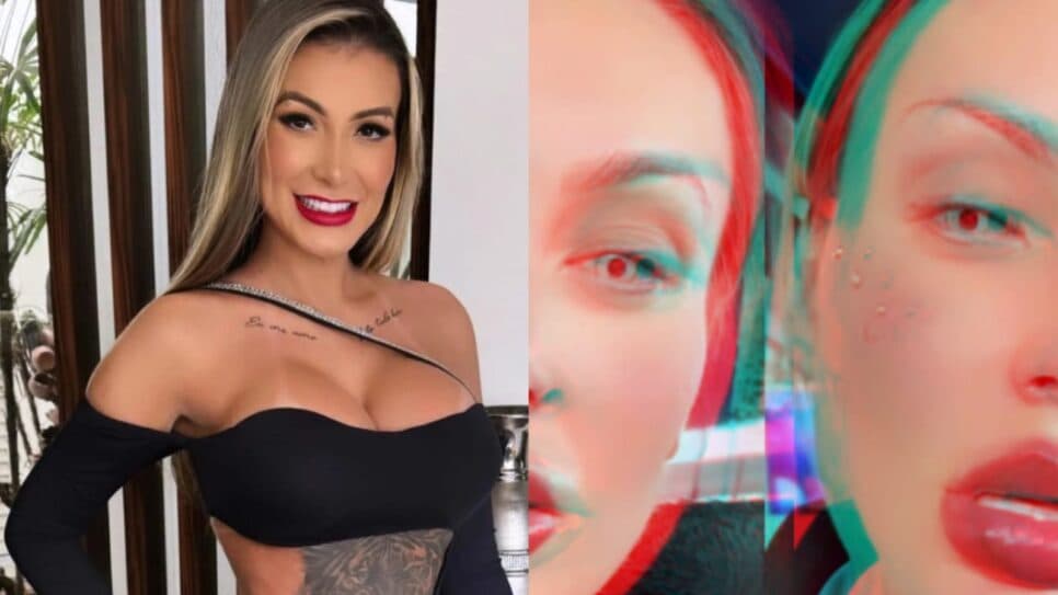 Andressa Urach faz procedimento, desfigura o próprio rosto e clama por orações: "Arrependida"