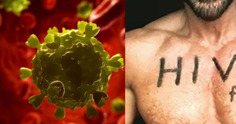 Quem são os 5 famosos que falam abertamente e tem HIV? Um deles brilhou em novela da Globo