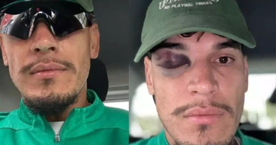 Gustavo Gómez posta foto com olho roxo - Foto: Instagram Gustavo Gómez posta foto com olho roxo - Foto: Instagram