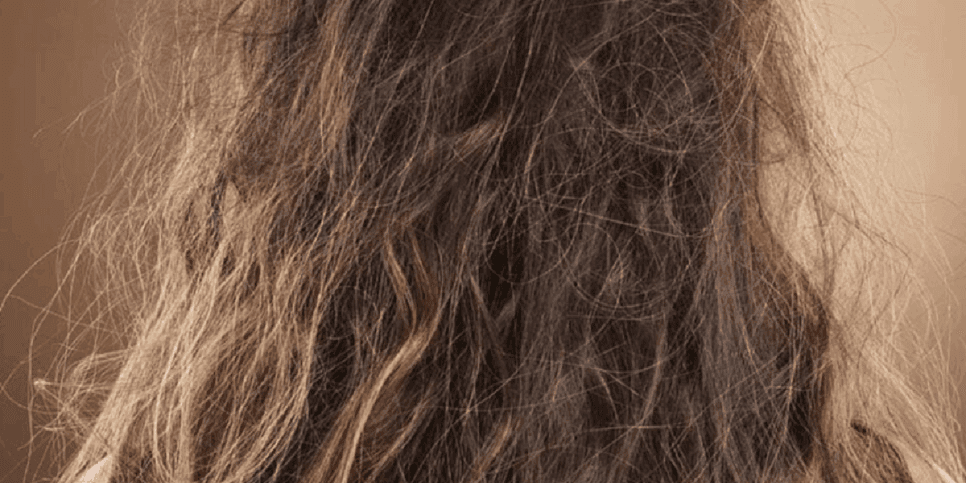 Cabelo com nó, frizz e pontas duplas (Foto: Reprodução/Internet) Cabelo com nó, frizz e pontas duplas (Foto: Reprodução/Internet)
