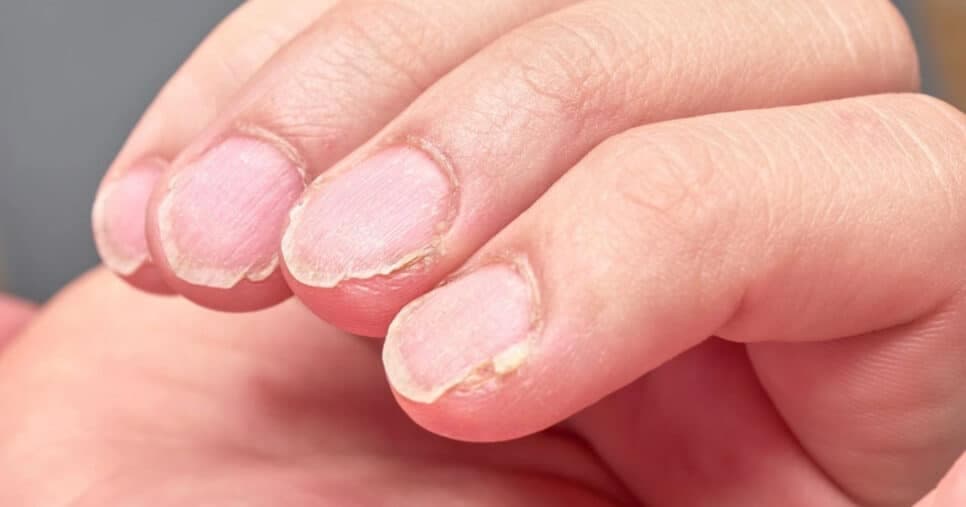 3 coisas que estão acabando com as suas unhas (Foto: Divulgação) 3 coisas que estão acabando com as suas unhas (Foto: Divulgação)
