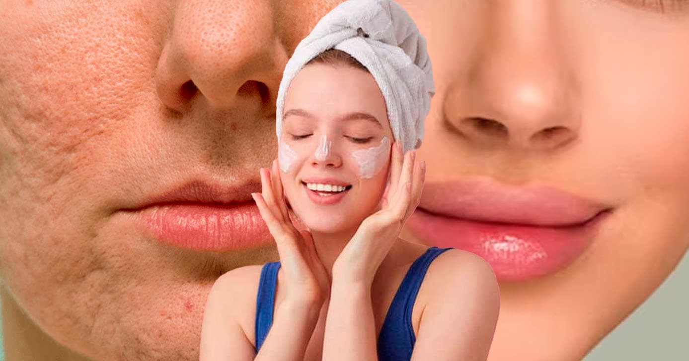 Resultado na manhã seguinte: Creme noturno reduz poros dilatados e marcas de acne