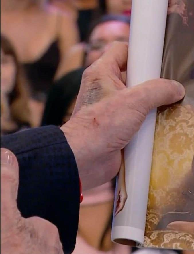 Silvio Santos aparece com machucado na mão (Foto: Reprodução/SBT) Silvio Santos aparece com machucado na mão (Foto: Reprodução/SBT)