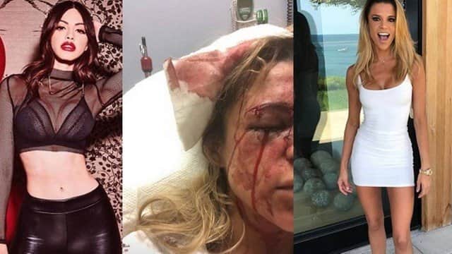 Duda Castro teria agredido modelo apontada como namorada do cantor (Foto: Reprodução) Duda Castro teria agredido modelo apontada como namorada do cantor (Foto: Reprodução)
