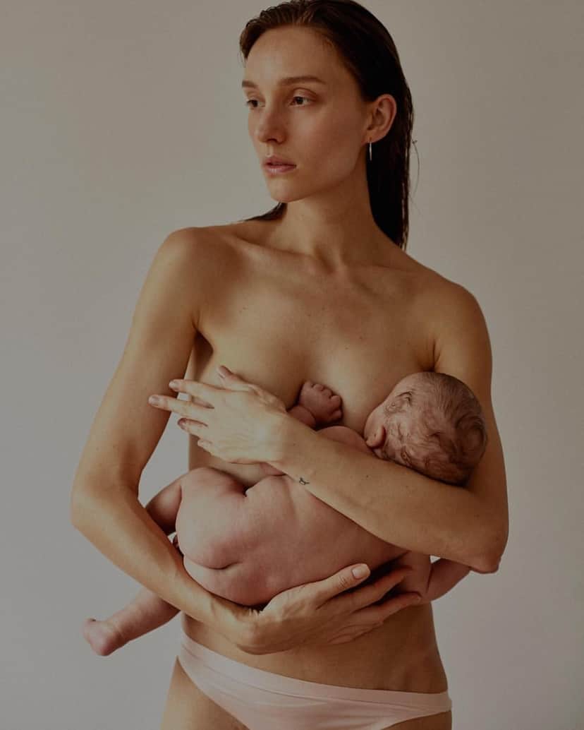 Isabel Hickman com seu filho Francisco, que nasceu com lábio leporino. Isabel Hickman com seu filho Francisco, que nasceu com lábio leporino.