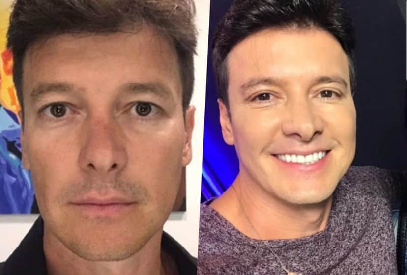 Rodrigo Faro faz procedimento no rosto; veja antes e depois Rodrigo Faro faz procedimento no rosto; veja antes e depois