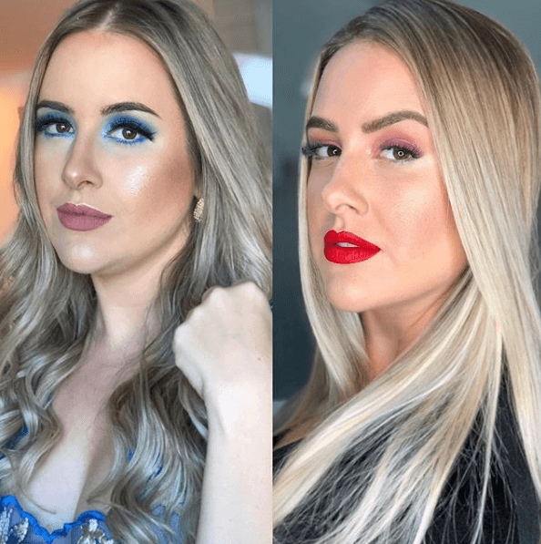 Patrícia Leitte antes e depois da cirurgia (Foto: Reprodução/ Instagram) Patrícia Leitte antes e depois da cirurgia (Foto: Reprodução/ Instagram)