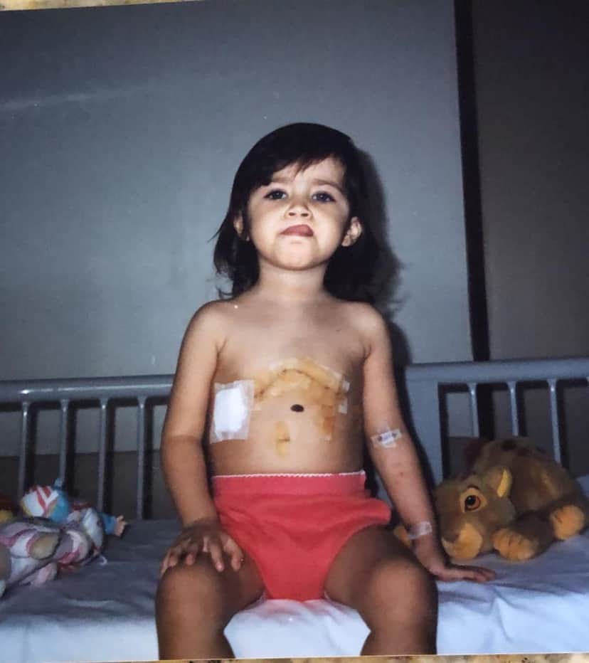 Jéssica Costa publicou foto na infância após cirurgia cardíaca (Foto: Reprodução/Instagram) Jéssica Costa publicou foto na infância após cirurgia cardíaca (Foto: Reprodução/Instagram)