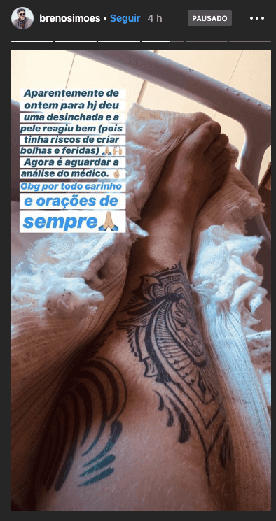 famoso famoso