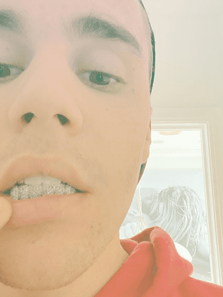 Justin Bieber posta foto com placa de diamante nos dentes (Foto: Reprodução) Justin Bieber posta foto com placa de diamante nos dentes (Foto: Reprodução)