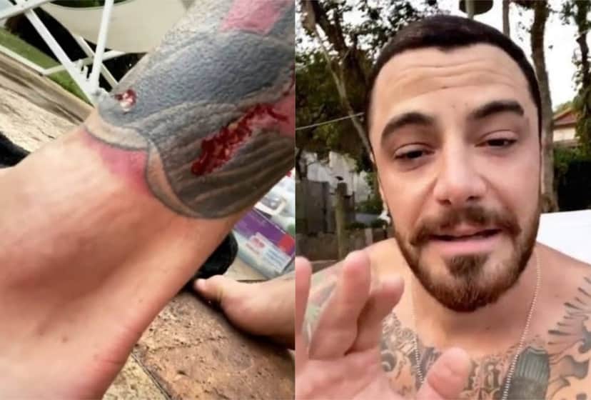 Felipe Titto após ser atacado por seu cachorro (Foto: montagem TV Foco) Felipe Titto após ser atacado por seu cachorro (Foto: montagem TV Foco)