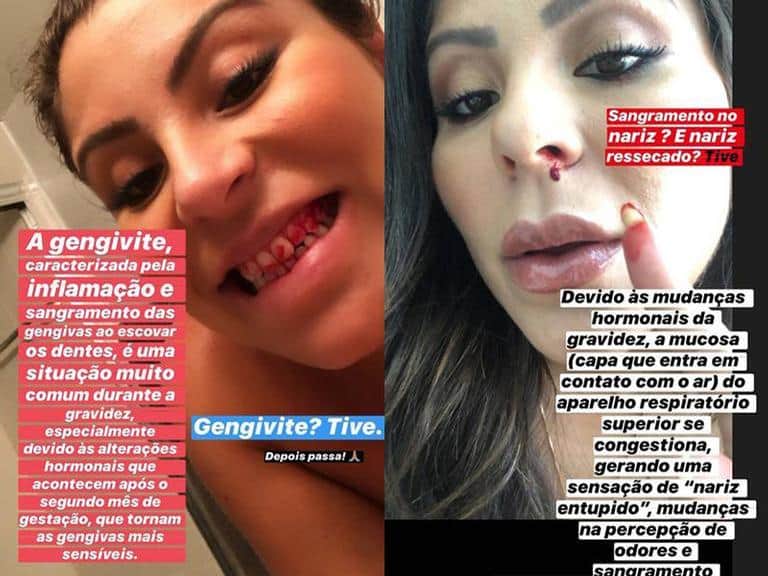 Andressa Ferreira enfrentou problemas com sangramento durante a gravidez (Foto: Reprodução/ Instagram) Andressa Ferreira enfrentou problemas com sangramento durante a gravidez (Foto: Reprodução/ Instagram)