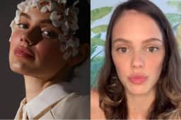 Laura Neiva, esposa de Chay Suede, expõe sofrimento e preconceito com doença em desabafo destruidor: “Vergonha”