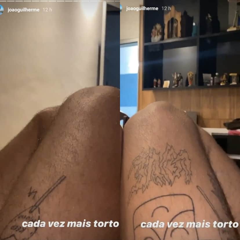 João Guilherme mostrou seu joelho deformado nos stories (Foto: reprodução/Instagram) João Guilherme mostrou seu joelho deformado nos stories (Foto: reprodução/Instagram)