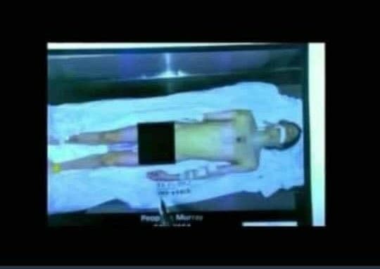 Vaza suposta foto do corpo de Michael Jackson Vaza suposta foto do corpo de Michael Jackson