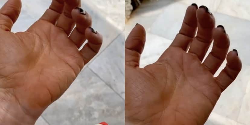 A famosa empresária e mulher do cantor sertanejo Leonardo, Poliana Rocha agitou as redes sociais após mostrar manchas (Foto: Reprodução/Montagem TV Foco) A famosa empresária e mulher do cantor sertanejo Leonardo, Poliana Rocha agitou as redes sociais após mostrar manchas (Foto: Reprodução/Montagem TV Foco)