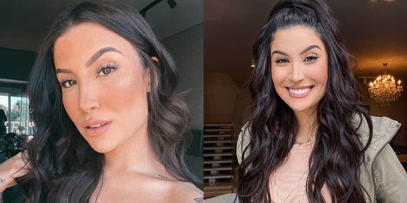 Bianca Andrade após receber alta, realiza novo procedimento estético (Foto: Reprodução/Instagram) Bianca Andrade após receber alta, realiza novo procedimento estético (Foto: Reprodução/Instagram)