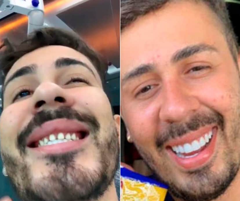 Carlinhos Maia sem e com lente nos dentes Carlinhos Maia sem e com lente nos dentes