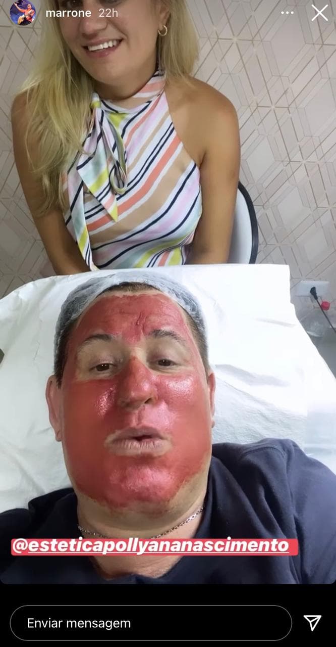 Marrone surgiu desorientado em cama (Foto: Reprodução) Marrone surgiu desorientado em cama (Foto: Reprodução)