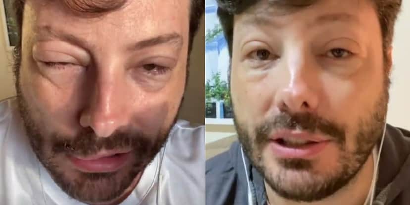 Danilo Gentili surgiu com rosto deformado na web (Imagem: Montagem) Danilo Gentili surgiu com rosto deformado na web (Imagem: Montagem)