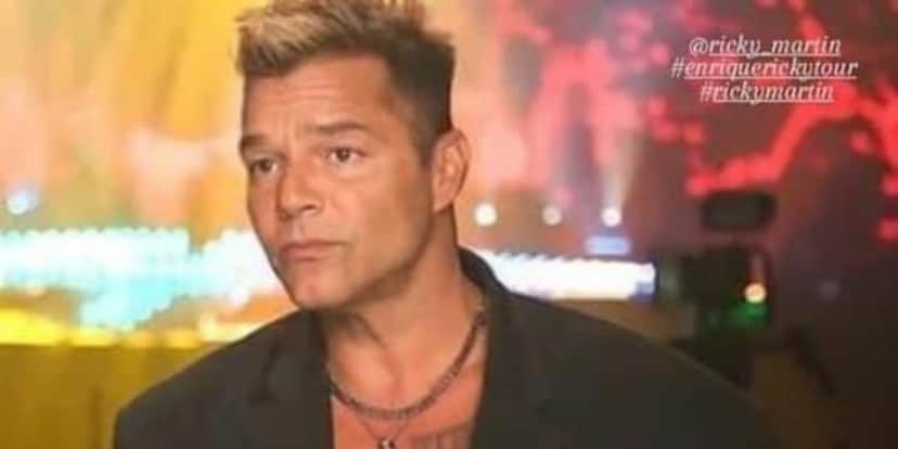 Ricky Martin fica com rosto desfigurado e choca até Marcos Mion - Foto: Reprodução Ricky Martin fica com rosto desfigurado e choca até Marcos Mion - Foto: Reprodução