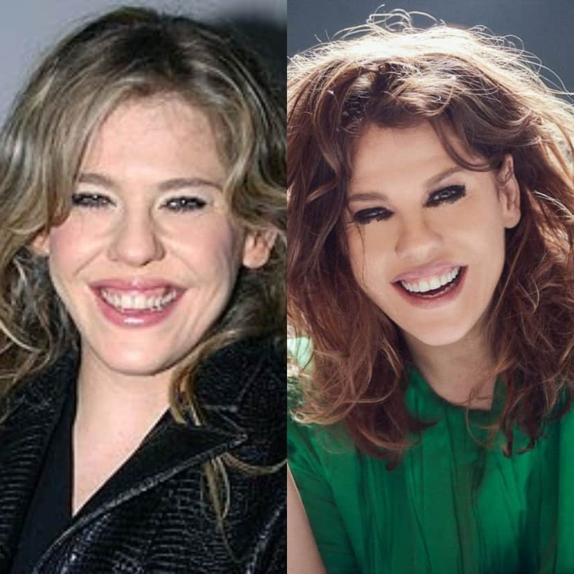Bárbara Paz, antes e depois de mudar sorriso Bárbara Paz, antes e depois de mudar sorriso